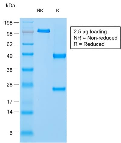 IHC-plus™ NAPSA / NAPA / Napsin A Antibody (aa189-299, clone rNAPSA/1239)