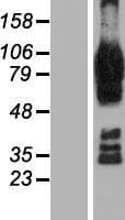 AFAP1L2 / XB130 Protein (Over-Expression Lysate Myc-DDK (Flag))