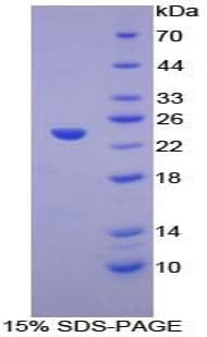 Human LAT2 / NTAL Protein (Recombinant His-T7)
