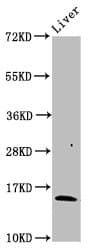 IHC-plus™ HBB / Hemoglobin Beta Antibody (aa1-147)