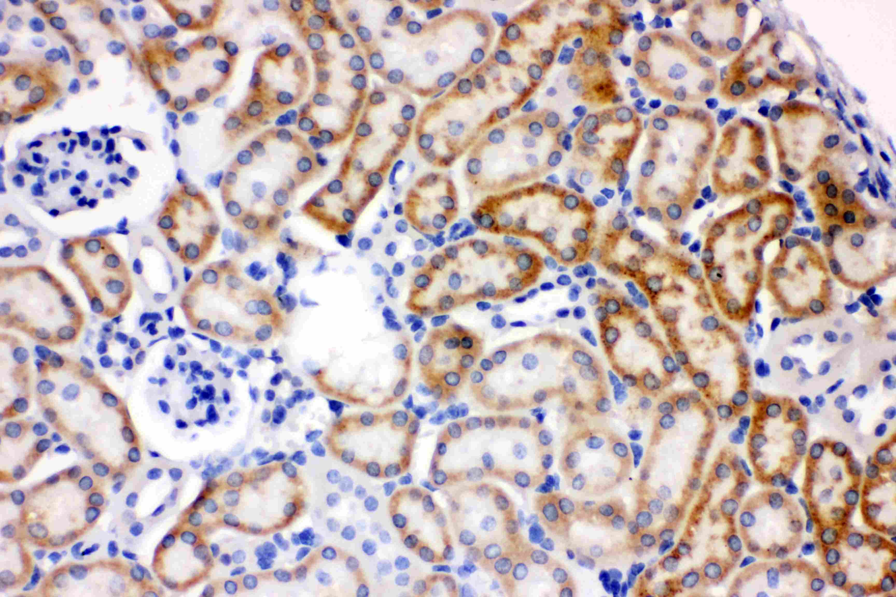 AK2 / Adenylate Kinase 2 Antibody