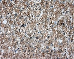 Monoclonal Mouse anti-Human BTK Antibody (clone OTI3D11, IHC, IF, WB)