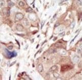Polyclonal Rabbit anti-Human KDR / VEGFR2 / FLK1 Antibody (aa1326-1356, IHC, IF, WB)
