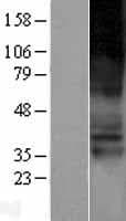 SLC22A4 / OCTN1 Protein (Over-Expression Lysate Myc-DDK (Flag))