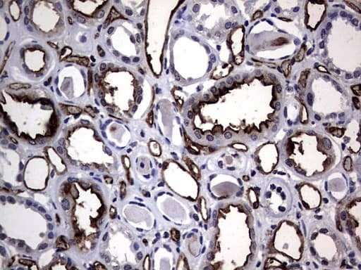 CEACAM5 / CD66e Antibody (aa35-680, clone OTI1C2)