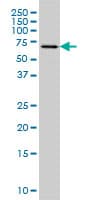 IHC-plus™ FGR Antibody (clone 3G10)