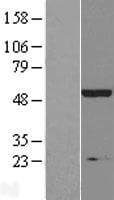IP6K2 Protein (Over-Expression Lysate Myc-DDK (Flag))