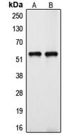 Polyclonal Rabbit anti-Human CYP39A1 Antibody (Internal, IHC, WB)