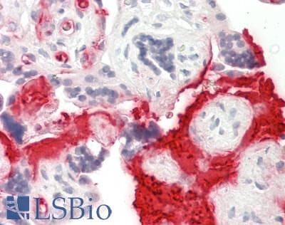 TNFSF15 / TL1A / VEGI Antibody (aa103-152)