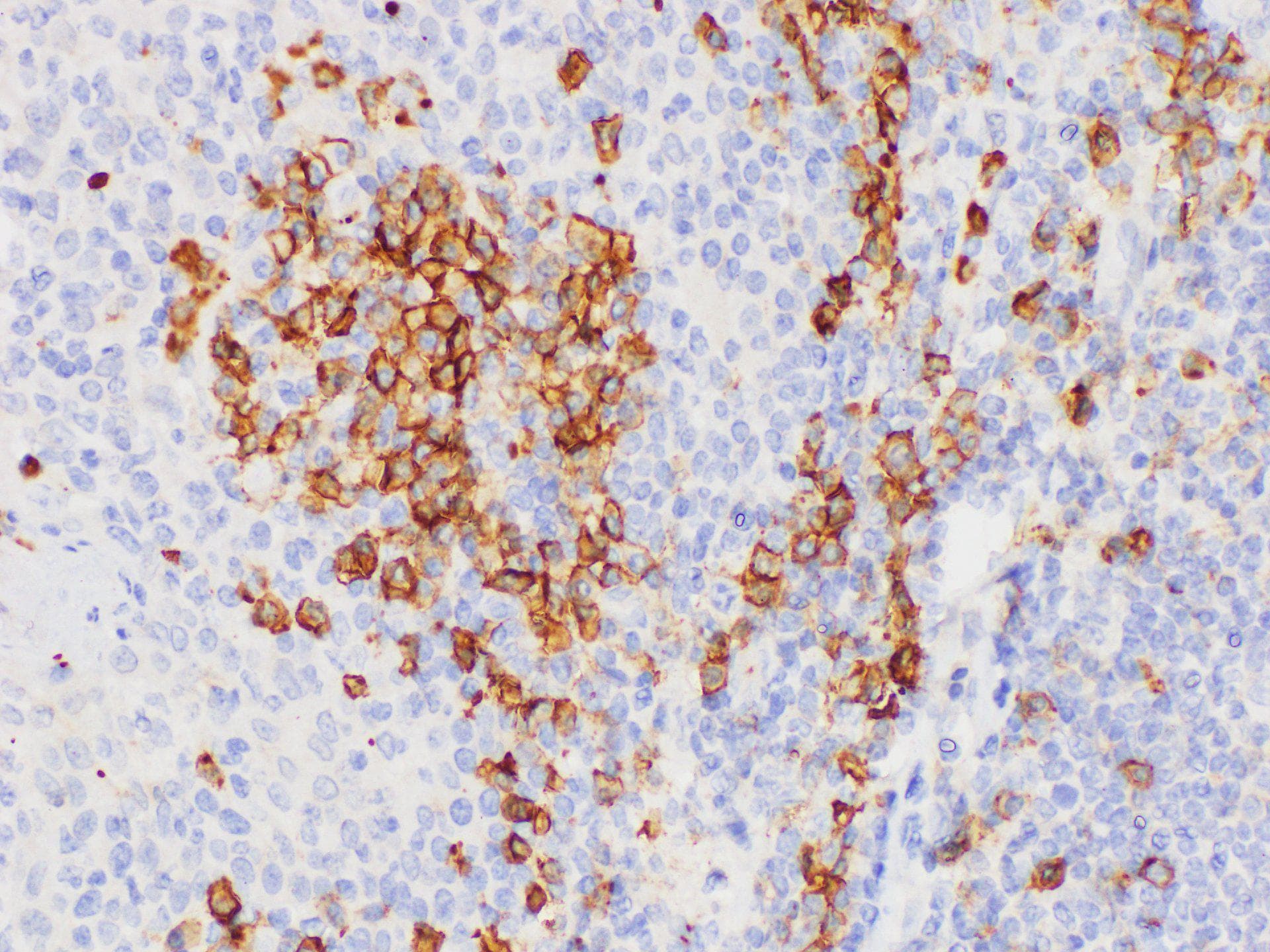 CD38 Antibody