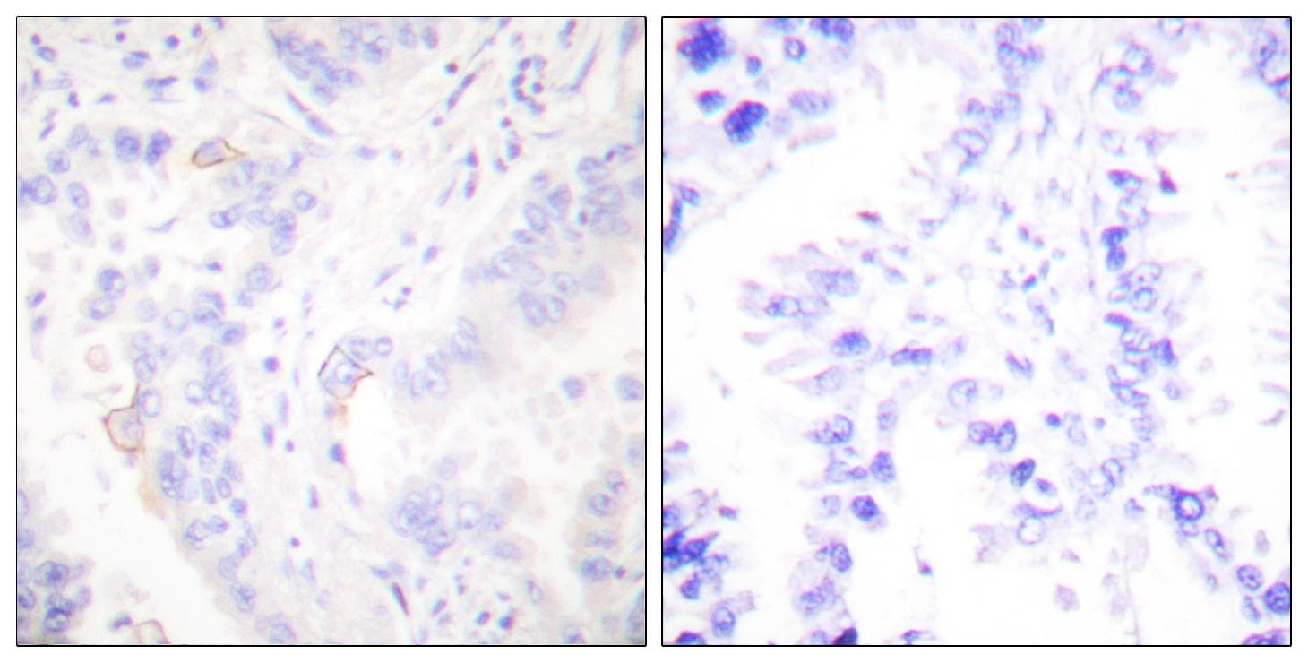 CRK Antibody (p221)