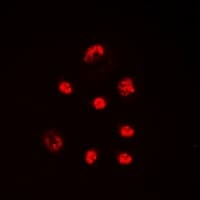 SSB / La Antibody (phospho-Ser366)