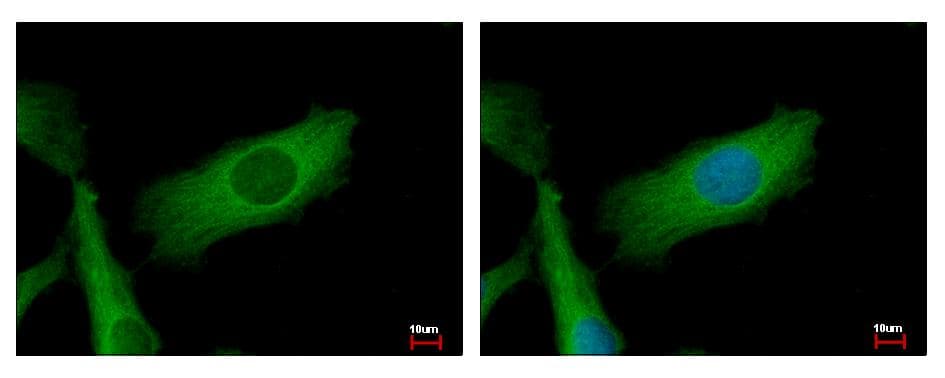 IHC-plus™ NDUFS2 Antibody (aa200-430)