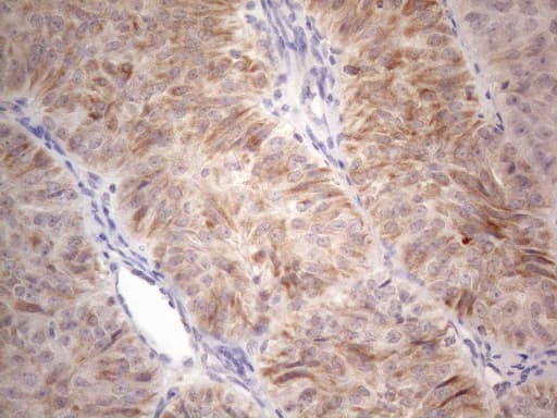 Monoclonal Mouse anti-Human RORB / ROR Beta Antibody (clone OTI1G1, aa1-260, IHC, WB)