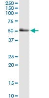 PAK2 Antibody (clone 1E1)