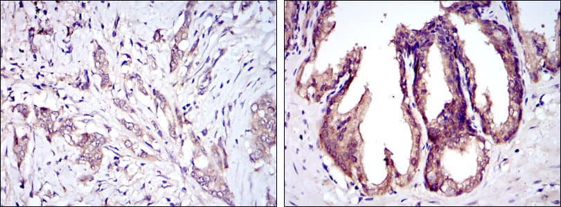 MAP3K5 / ASK1 Antibody (clone 2E4)