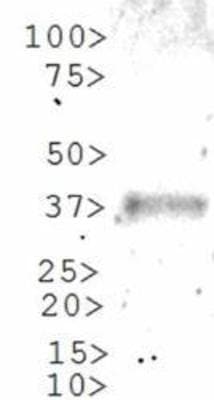 GLI / GLI1 Antibody