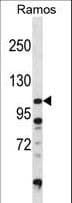 DGKZ Antibody (aa989-1019)
