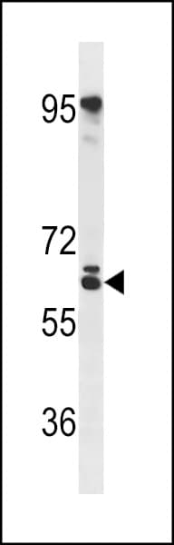 Polyclonal Rabbit anti-Human RSPRY1 Antibody (aa70-99, WB)
