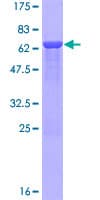 Human NMI Protein (Recombinant GST)