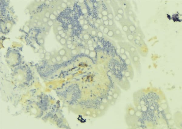 RAB43 Antibody