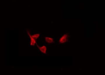 Polyclonal Rabbit anti-Human UBAP2L Antibody (IF, WB)