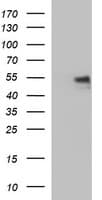 IL6R / IL6 Receptor Antibody (clone OTI1B5)