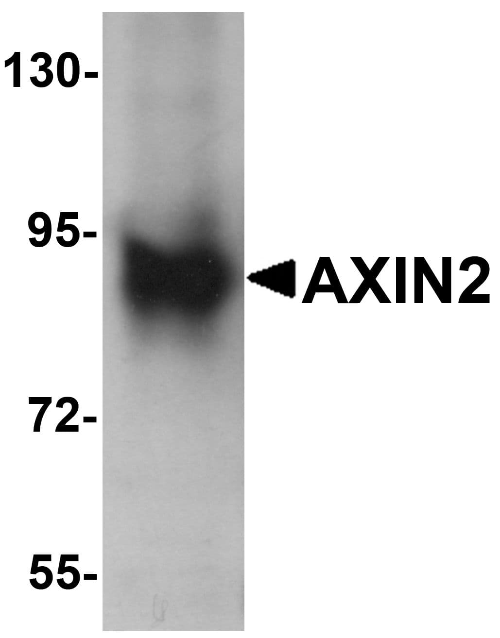 PathPlus™ Polyclonal Rabbit anti-Human AXIN2 / Axin 2 Antibody (IHC, IF, WB)