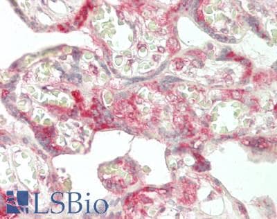 IHC-plus™ LRPAP1 Antibody