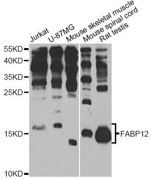 FABP12 Antibody