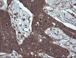 TCL / RHOJ Antibody (clone OTI1C8)