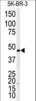 IHC-plus™ ADRB2 Antibody (Thr384)