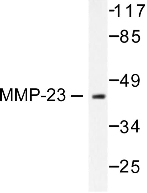 Polyclonal Rabbit anti-Human MMP23 Antibody (Val371, WB)