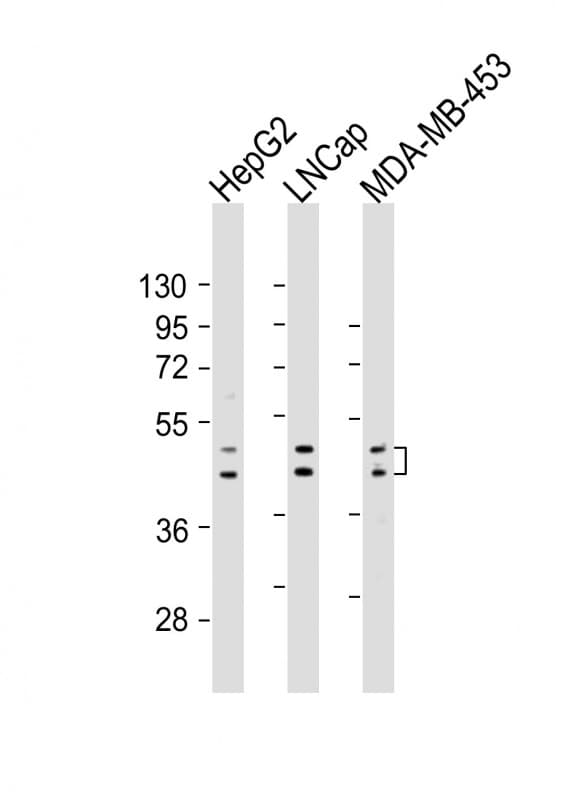 Polyclonal Rabbit anti-Human UGT2B4 Antibody (aa338-370, WB)