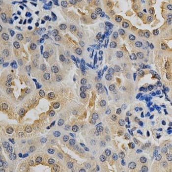 Polyclonal Rabbit anti-Human MAPK10 / JNK3 Antibody (IHC, WB)