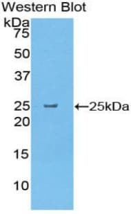CELA1 / Pancreatic Elastase 1 Antibody (aa44-259, APC)