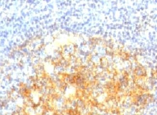 VCAM1 / CD106 Antibody (clone VCAM1/843)