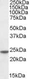 IHC-plus™ TAGLN / Transgelin / SM22 Antibody (aa190-201)
