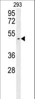 Polyclonal Rabbit anti-Human LUZP4 Antibody (aa33-62, IHC, WB)