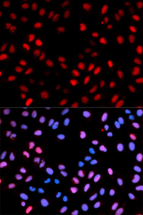 Polyclonal Rabbit anti-Human RAF1 / RAF Antibody (phospho-Ser621, IF, WB)