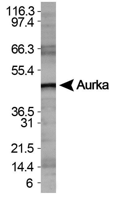 AURKA / Aurora-A Antibody