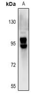 Polyclonal Rabbit anti-Human SLCO1B1 / OATP2 Antibody (WB)