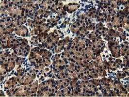 EPHX2 / Epoxide Hydrolase 2 Antibody (clone OTI1A6, Carrier-free)
