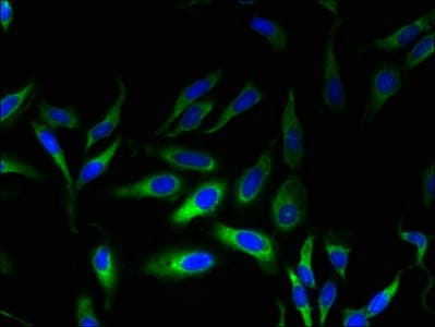 MPV17 Antibody (aa1-176)