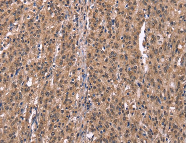Polyclonal Rabbit anti-Human HRH1 / Histamine H1 Receptor Antibody (IHC, WB)