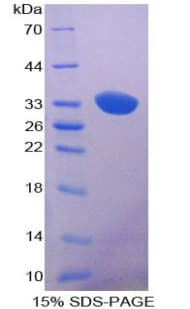 Human PRKAA1 / AMPK Alpha 1 Protein (Recombinant His-T7)