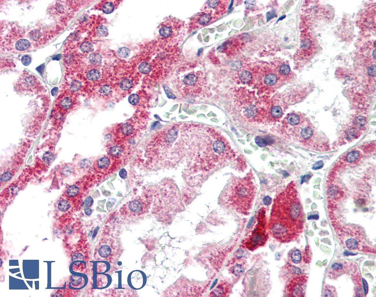 IHC-plus™ Polyclonal Rabbit anti-Human Apg7 / ATG7 Antibody (C-Terminus, IHC, WB)