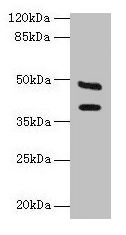 IHC-plus™ Polyclonal Rabbit anti-Human CA12 / Carbonic Anhydrase XII Antibody (aa25-301, IHC, WB)