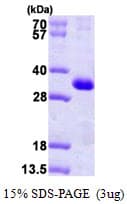 Human KCNIP3 / Dream / Calsenilin Protein (Recombinant His)