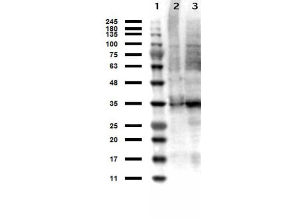 TS / Thymidylate Synthase Antibody (Liquid)